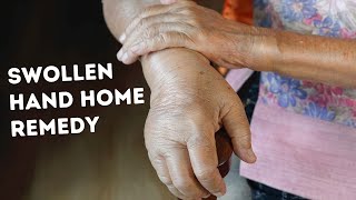 Hand Swelling Home Remedy| What to do when Hand Swells screenshot 5