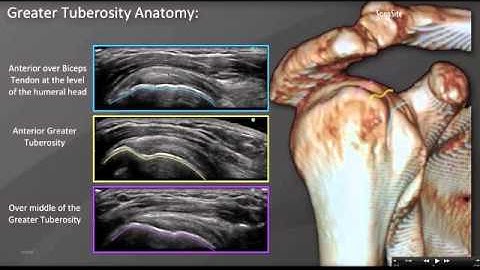 Webinar: Diagnostic Shoulder Ultrasound Exam - Part 1