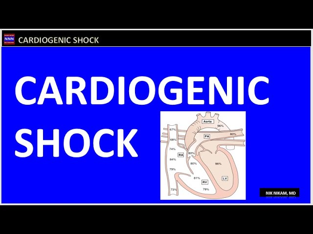 Cardiogenic Shock Review  by Nik Nikam MD