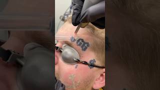 Download Lagu Satu detik $200 Rahasia Teknik Menghapus Tattoo MP3