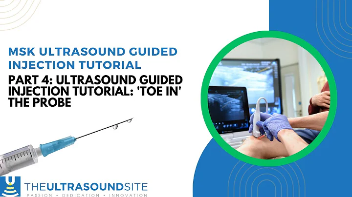 Part 4: Ultrasound guided injection tutorial: 'Toe in' the probe