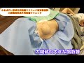 大腿部の大きな脂肪腫　ブログでもこの症例について詳しく解説してます。東京皮膚のできものと粉瘤クリニック　ふるばやし形成外科新宿院　大阪梅田形成外科クリニック
