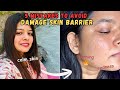 STOP ❌ Damaging Your Skin Barrier! Top 5  Mistakes That Destroyed My Skin Barrier