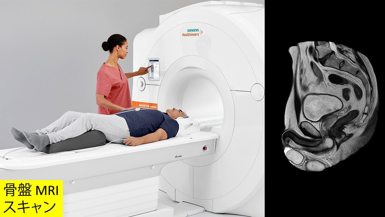 裁断済み・最新版】エキスパートのための脊椎脊髄疾患のMRI 第3版