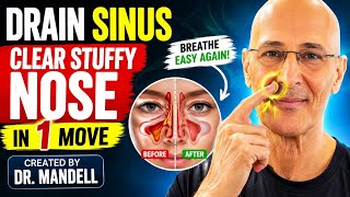 Clear a Stuffy Nose in 1 Simple Move (Drain Your Sinuses Fast!)