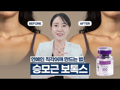 승모근 보톡스, 제대로 효과보고 싶다면? 부작용 없이 예쁜 직각어깨 만드는 법💫