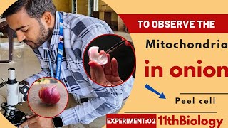 To Observe Mitochondria In Onion Peel Cell