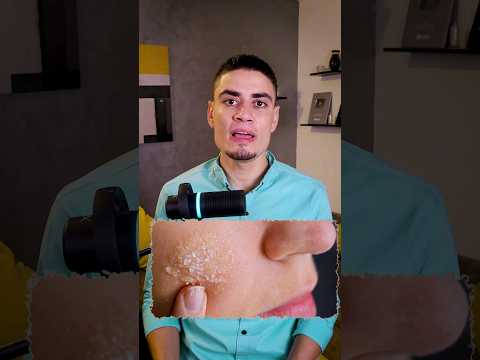 هصدمك 7 مرات في 30 ثانية ج17