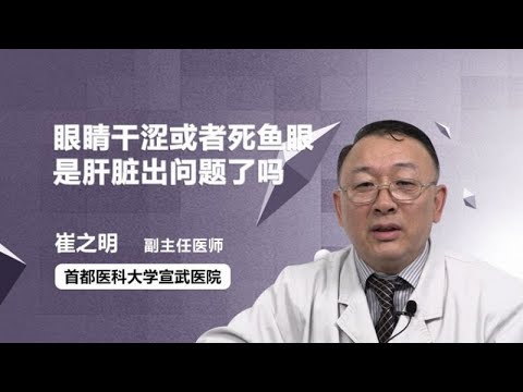 眼睛干涩或者死鱼眼是肝脏出问题了吗 崔之明 首都医科大学宣武医院