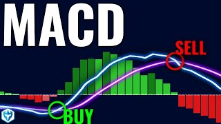 The Only Technical Indicator You'll EVER Need 🍏 3 Reasons Millionaire Traders Love MACD