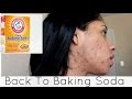 Back To Baking Soda 2 WEEKS Challenge - BEFORE