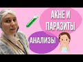 ЧАСТАЯ ПРИЧИНА АКНЕ- ПАРАЗИТЫ. АНАЛИЗЫ/АНТИТЕЛА/кдл/гельминты/аскарида/лямблии