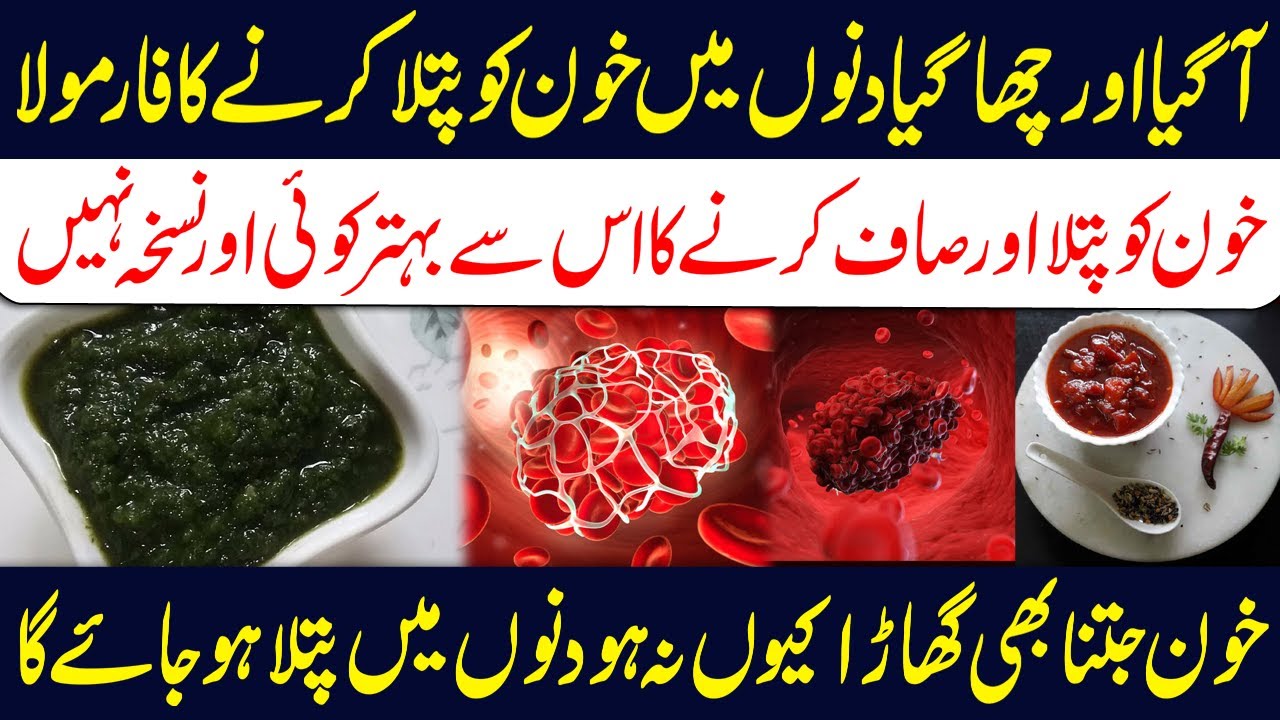 Khoon Ko Patla Karne Ka Tarika Blood Clot Ka ilaj Dr Sharafat Ali