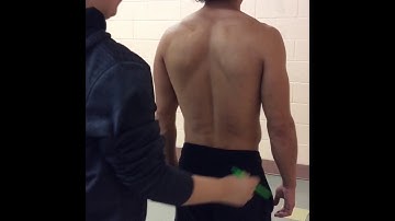 Skinfold measurements