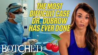 Dr. Dubrow Calls Kelsey’s Uniboob the Most Complex He’s Ever Seen (Before & After) | Botched | E!