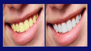 How To Whiten Teeth In Photoshop Easy Tutorial For A Brighter Smile