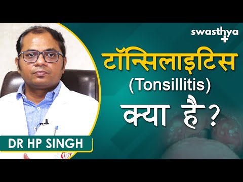 टॉन्सिलाइटिस क्या है? कारण, लक्षण, इलाज | Dr Hp Singh on Tonsillitis in Hindi | Causes & Treatment