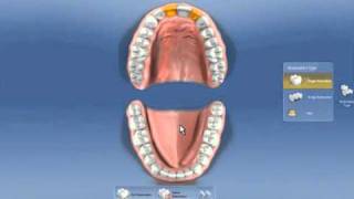 User Interface, Cerec 4.0 tutorial 1
