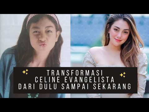 TRANSFORMASI CELINE EVANGELISTA DARI DULU SAMPAI SEKARANG