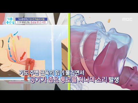 [기분 좋은 날] 갑자기 심해진 코골이, 혈관 건강 이상 <strong>신호일</strong> 수도 있다, MBC 260727 방송