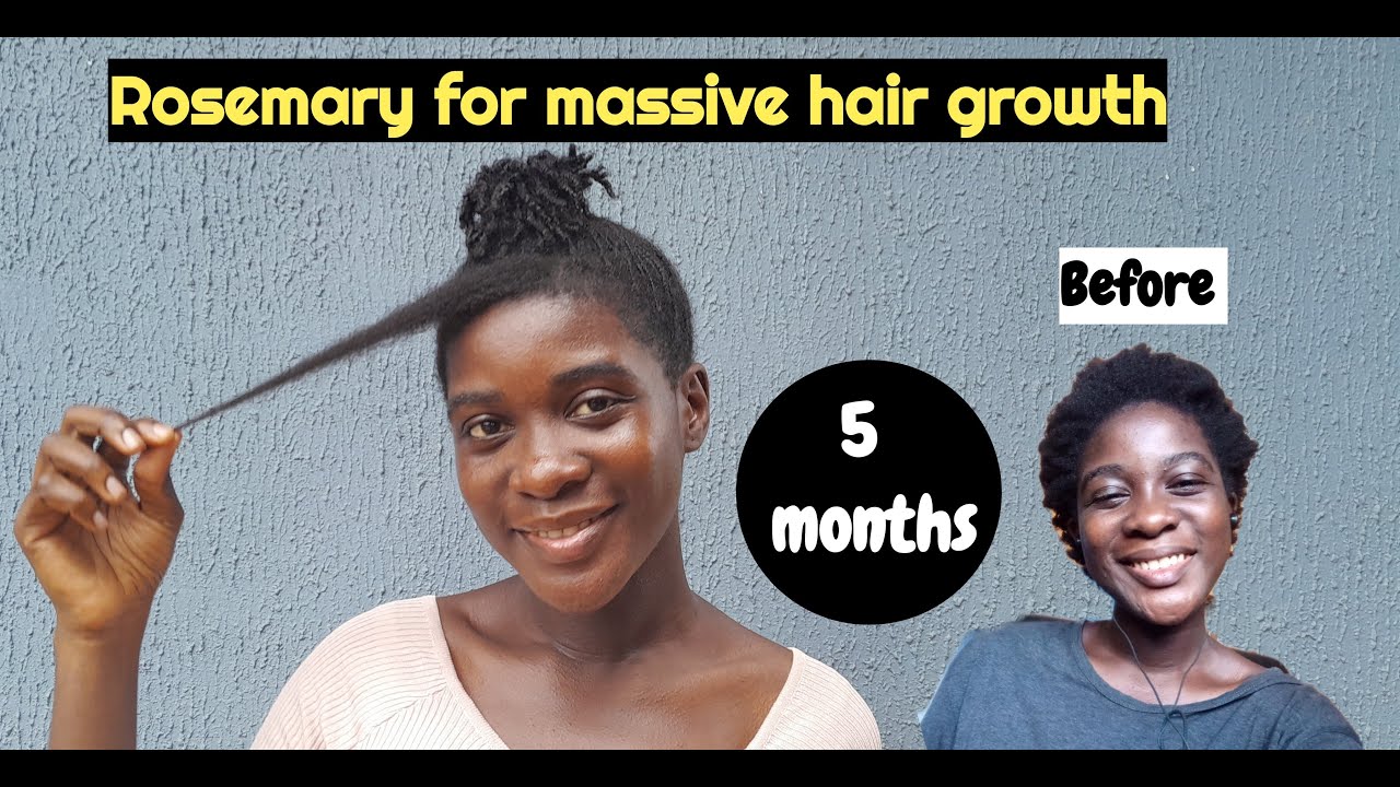 Rosemary Water For Massive Hair Growth + Before And After Results 4C