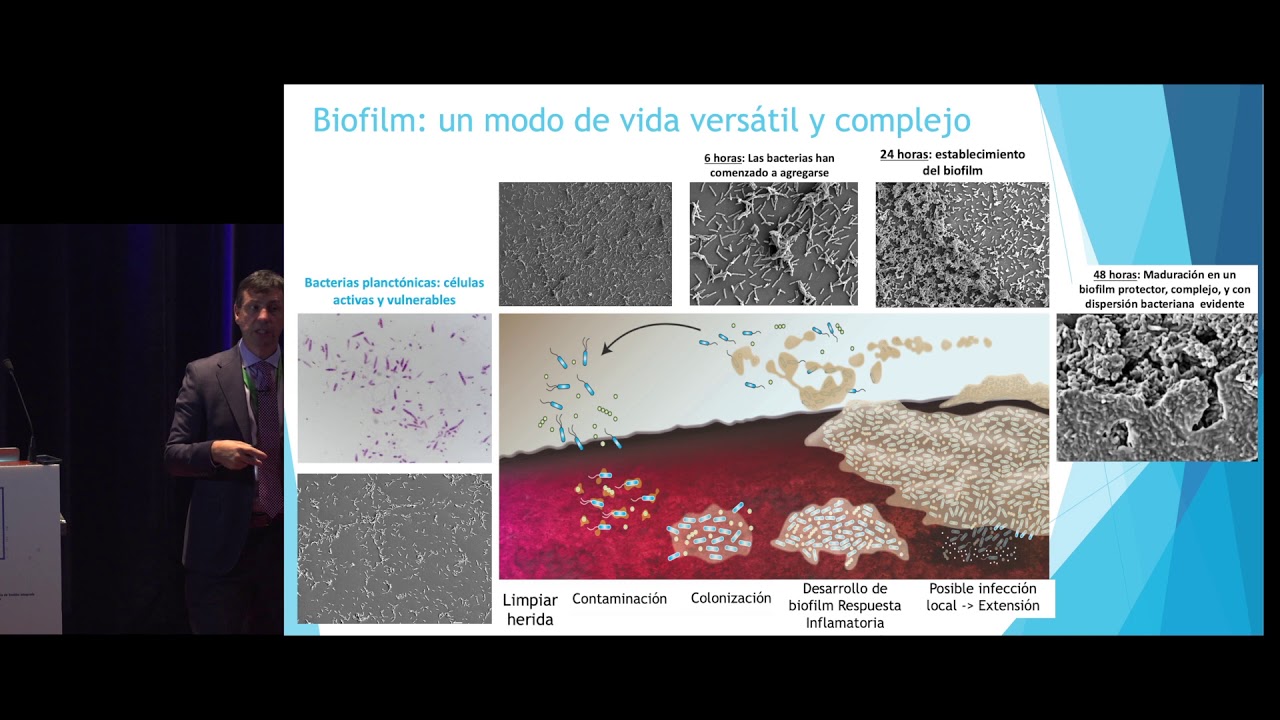 ¿QUÉ SABEMOS Y QUÉ NO SABEMOS SOBRE EL BIOFILM? YouTube