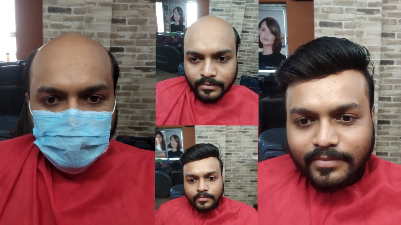 Hair Wig Center Surat Gujarat Mo 8200405991 Hair Wig Starting Price