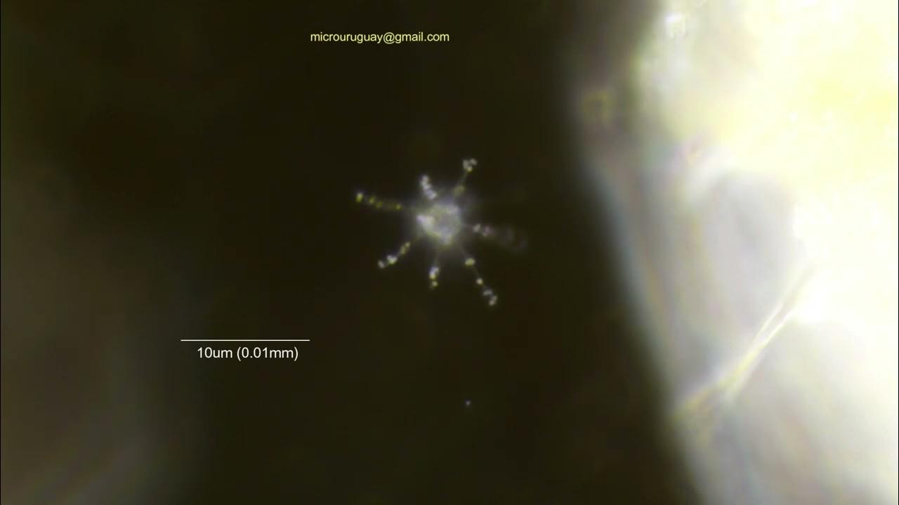 Heliozoo contrae axopodios Heliozoa contracts axopodia YouTube