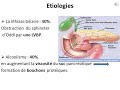 Pancreatite aigue dr bensetti