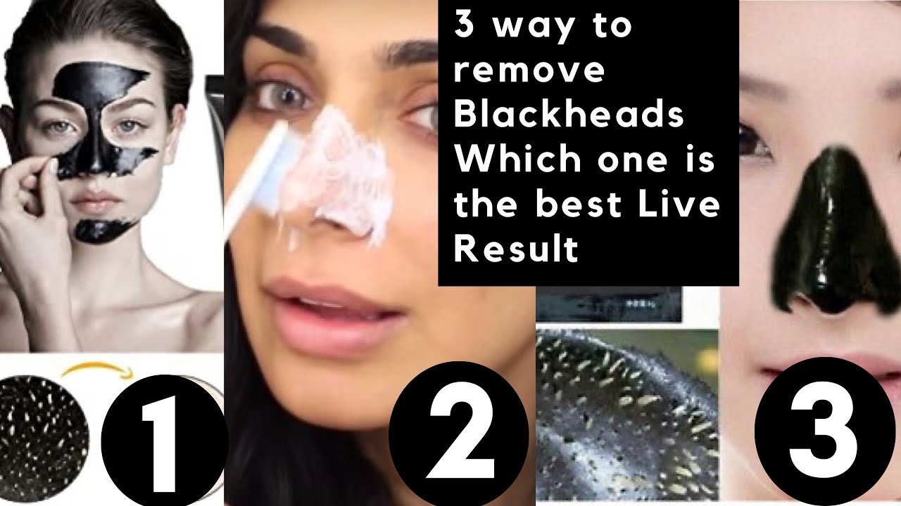How to Remove Blackheads & Whiteheads from Nose at home | 3 DIY ...