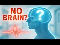 This Shocking Brain Case Defies Medical Science