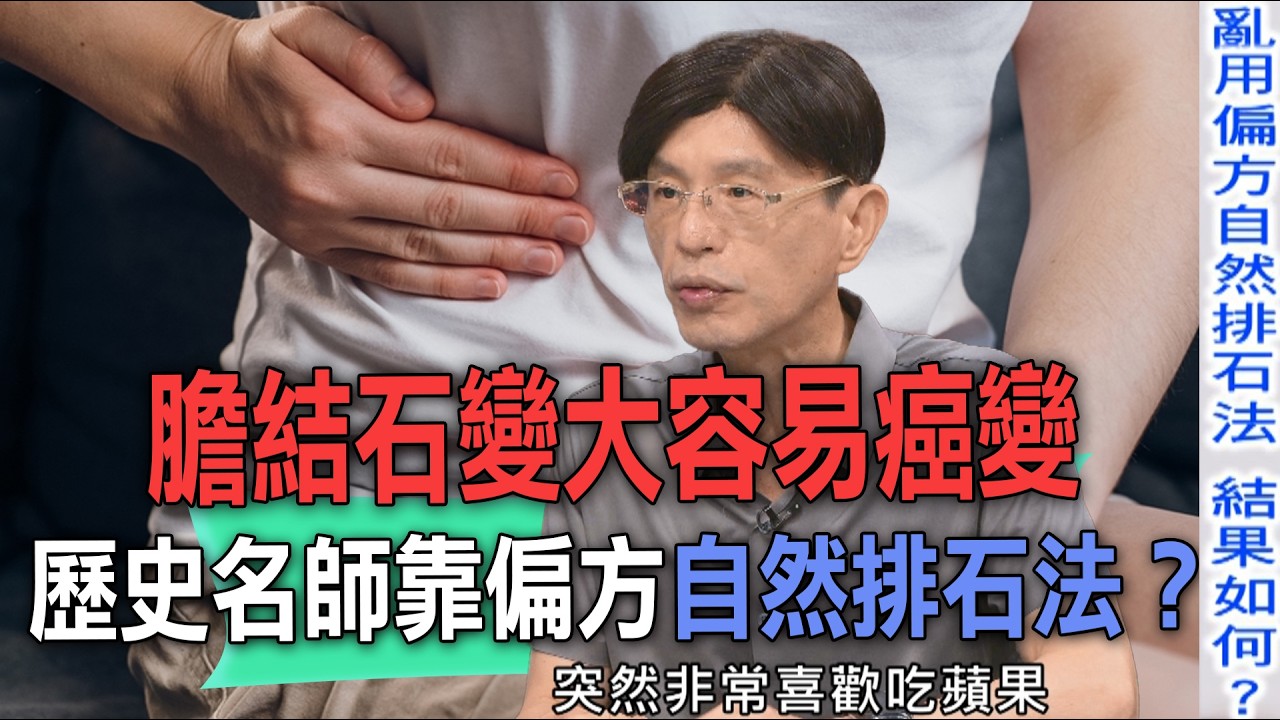發現膽結石變大容易癌變 歷史名師靠偏方自然排石法?【新聞挖挖哇】 縮圖