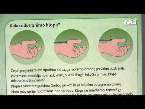 Video: Ali lahko peščene muhe pregriznejo oblačila?