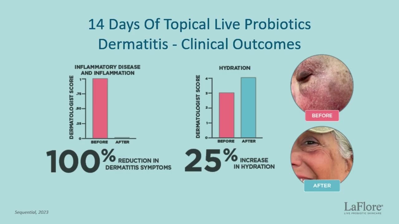 Living Skin Revolution | Free NASNPROtv Episode from LaFlore Live Probiotic Skincare