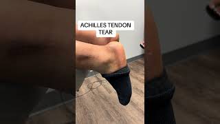 How do you know if you have an Achilles tendon tear? #achillestendon #tendon #footdoctor How To Identify A Torn Achilles