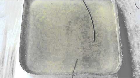 Flexible Needle Control by Jadav Das, Vanderbilt University