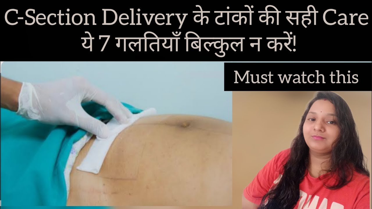 नई माँ के लिए जरूरी: C-Section टांकों की पूरी Care गाइड