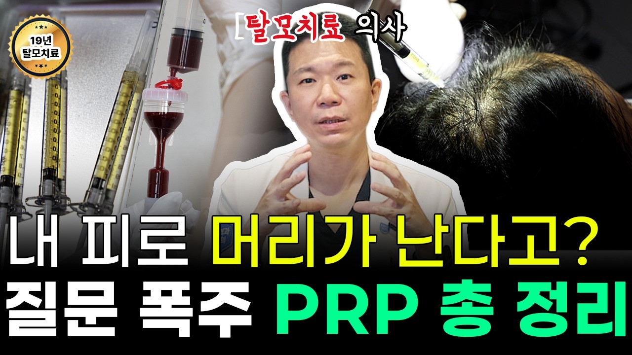 차세대 PRP의 등장? 탈모치료 의사가 말하는 효과, 부작용, 시술방법 (MCT 메타셀 PRP)
