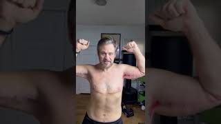 First time showing my previous armpit wounds and one is starting to close!