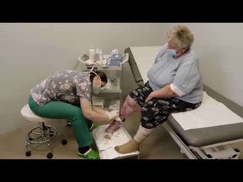 Wideo: Jak leczyć owrzodzenie żylne nóg: 12 kroków (ze zdjęciami)