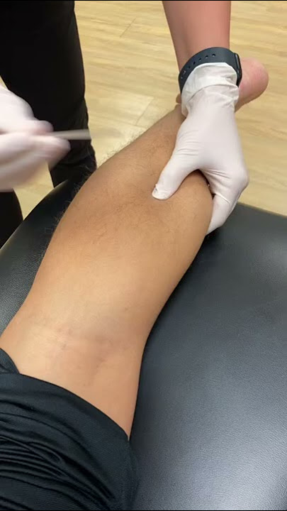 Dry Needling / Intramuscular Stimulation (IMS)​ - Trifecta Rehab