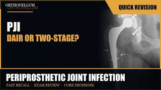Periprosthetic Joint Infection — Biofilm Changes Everything — Quick Revision (exam review)