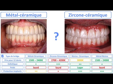 Vidéo: Emax est-il une zircone ?