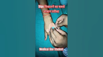Cannula कैसे निकाले। How to remove IV Cannula #youtubeshorts#shorts #vigo#cannula#medical #bams