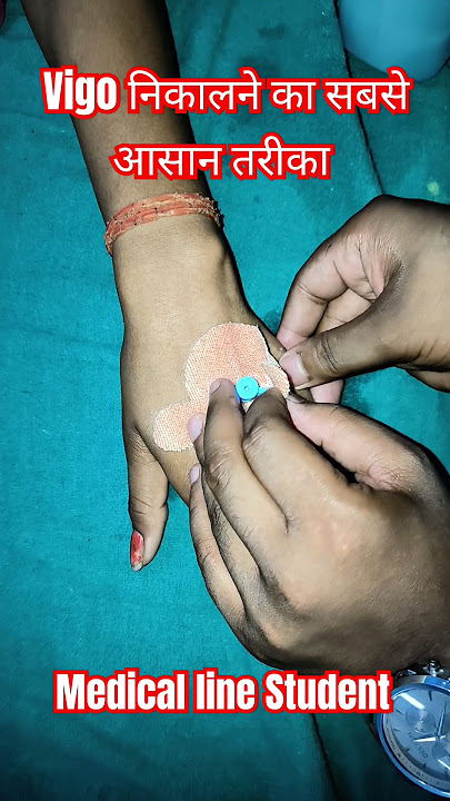 Cannula कैसे निकाले। How to remove IV Cannula #youtubeshorts#shorts #vigo#cannula#medical #bams