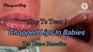Chapped Lips In Babies //Home Remedies for Cracked lips in Babies Details
