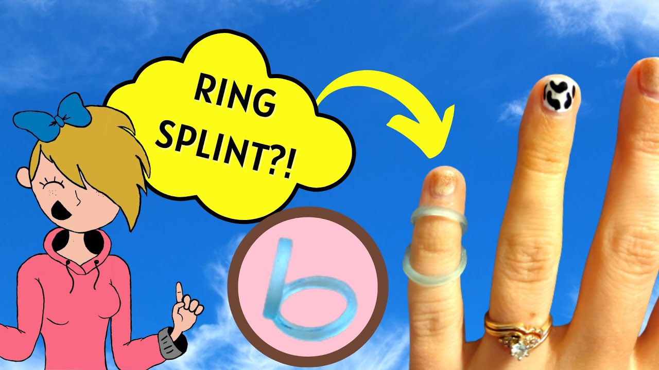 Spoonie Splints: Affordable Ring Splints for Hyper Mobile Fingers!~Pomchi Productions