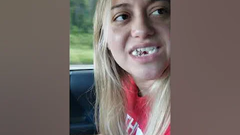 Wisdom teeth
