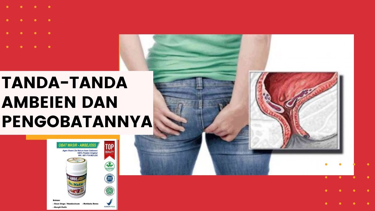 Cara Mengobati Ambeien Dengan Alami