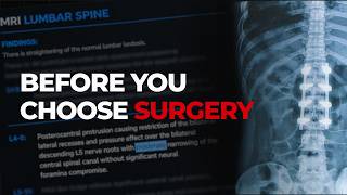 How to Read Your Lower Back MRI (Bulges, Stenosis, Slippage)